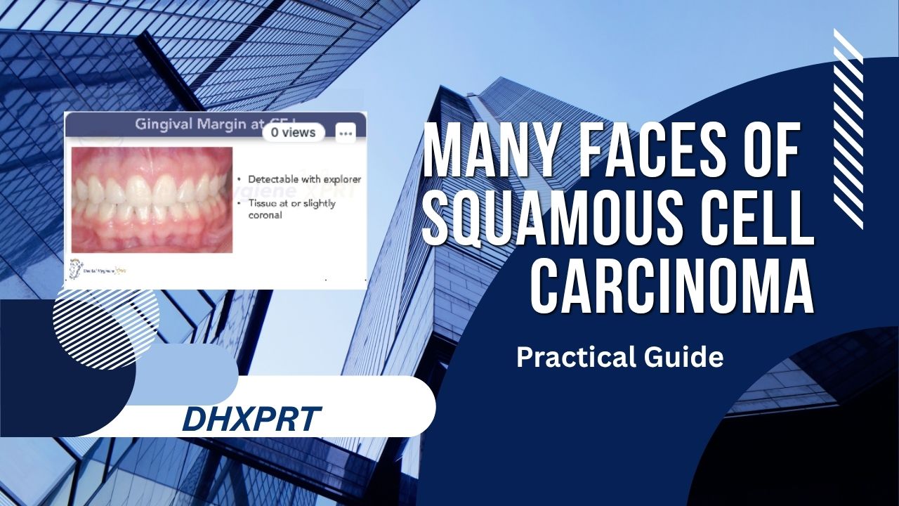 The Many Faces of Squamous Cell Carcinoma Practical Guide